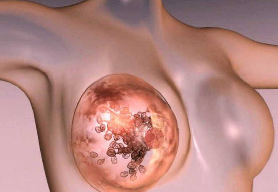 СОБЫТИЯ: Отсутствие секса может вызвать заболевания груди